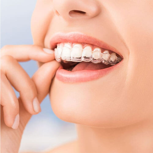 ABS Dentistry Invisalign Fort Lee