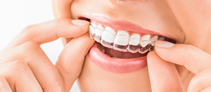 Wearing Best Invisalign in NJ