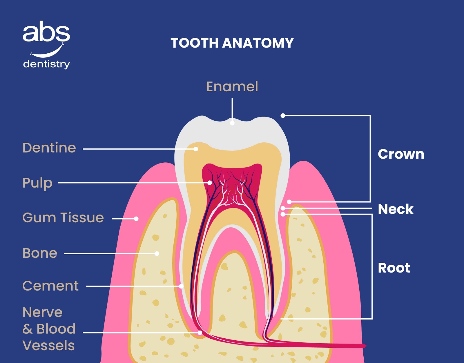 Best Teeth whitening image