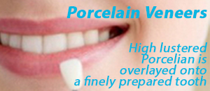 Porcelain Venner ABS Fort LEe Dental Office